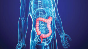 Colonoscopia este o investigatie ce permite examinarea intestinul gros (colonului), fiind o metoda de diagnostic a diferitelor afectiuni colonice, dar si de tratament pentru anumite patologii.